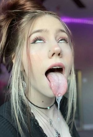 Pic - Braces Tongue