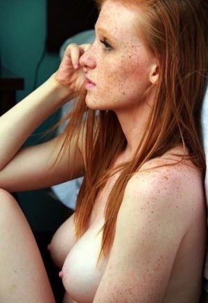 Pic - Frecklelicious